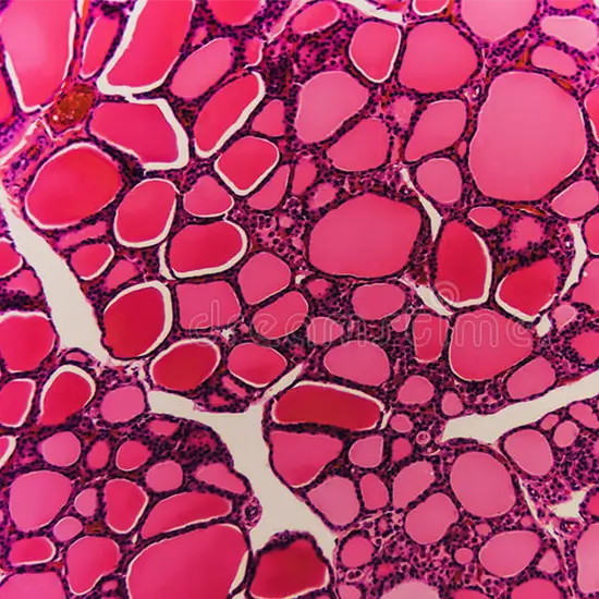 congenital hypothyroidism confirmatory panel serum test